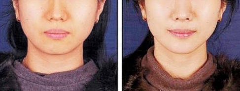 笑顔の作り方！！